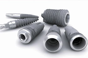 Implantes